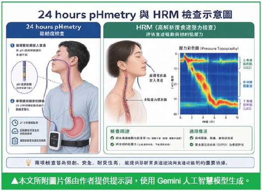 認識胃食道逆流:別讓火燒心成為日常