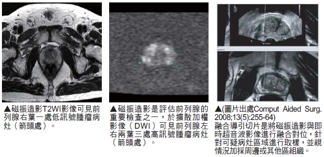 點亮抗癌新曙光!頭頸癌「光免疫療法」助癌細胞清零