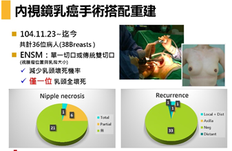 內視鏡乳癌手術搭配重建.png (81 KB)