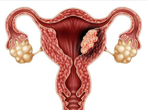 ovary.jpg (69 KB)