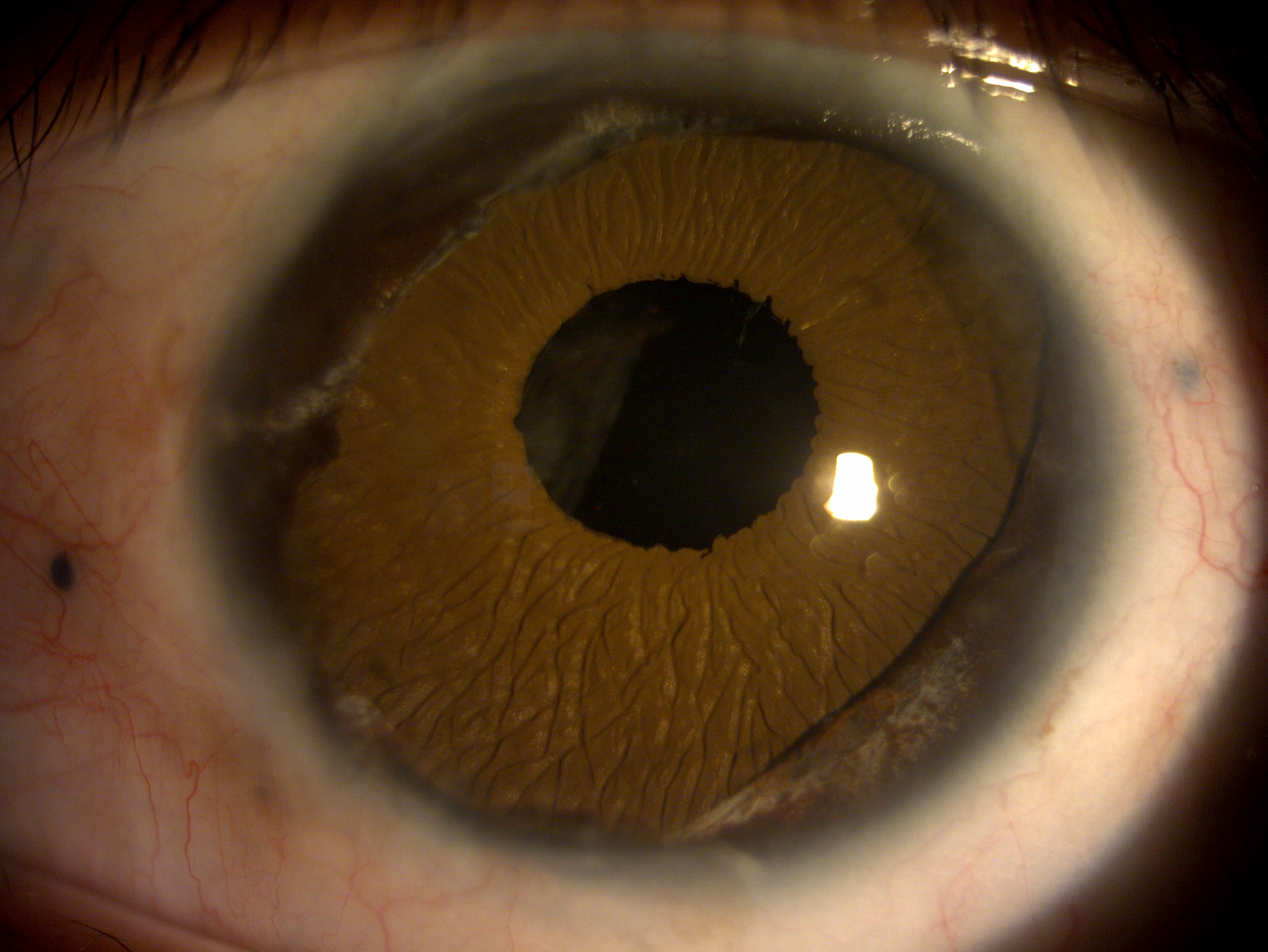 17099736_20230118_103951_DC4Image_L_9097.jpg (1.10 MB)