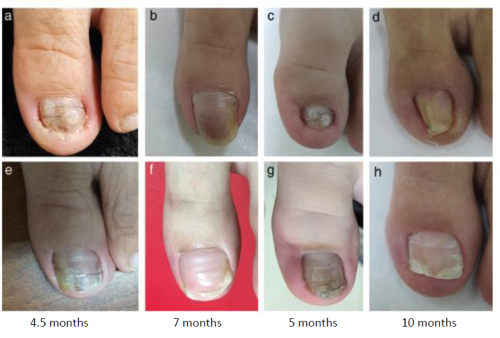 nail-1.png (365 KB)