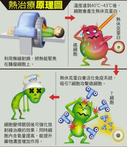 熱治療原理.jpg (171 KB)
