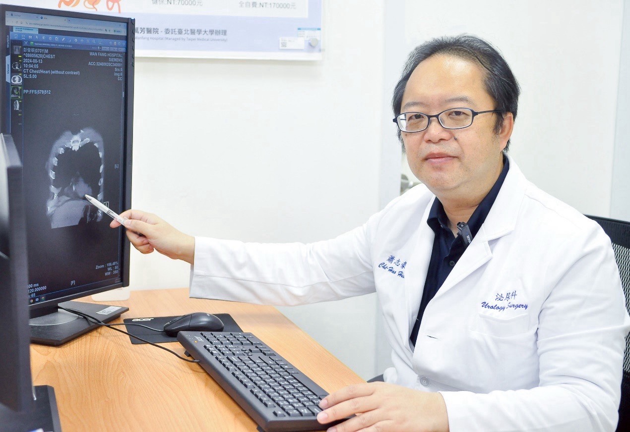 10分鐘微創手術助76歲男解尿順暢　新型療法避開麻醉風險